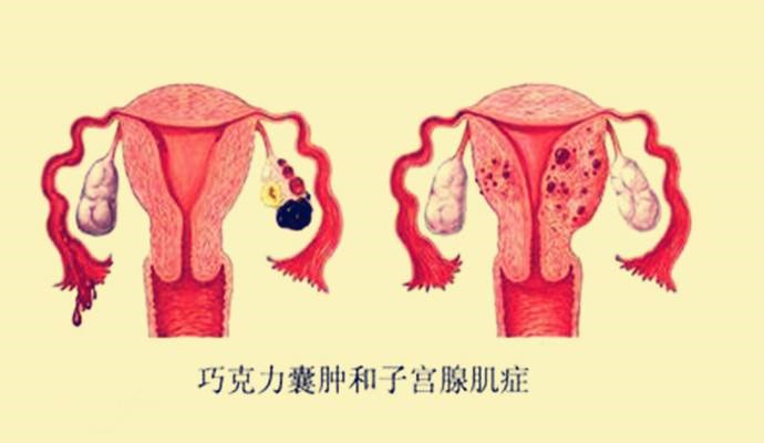 正常子宫宫内膜厚度_子宫没有内膜有月经吗_子宫内膜薄