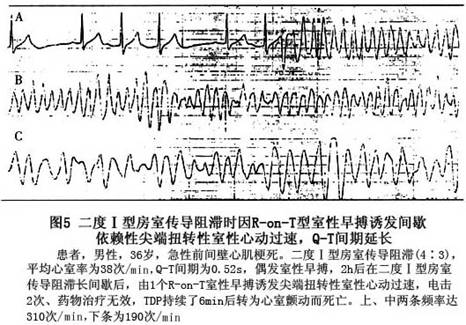长益复线望城征拆标准_长QT间期综合征_哈尔滨市区征地区片综合地价表2011
