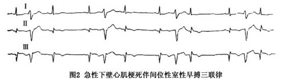 长QT间期综合征_哈尔滨市区征地区片综合地价表2011_长益复线望城征拆标准