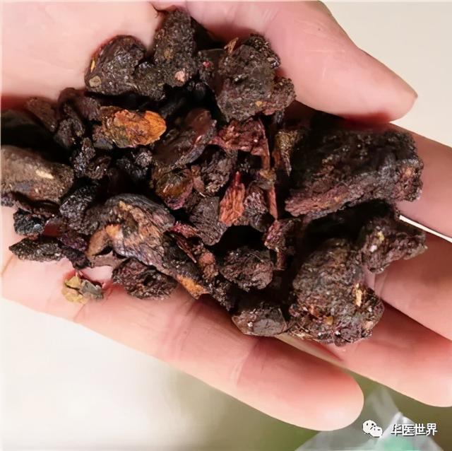 囊肿巧克力的治疗_麦德好 营养麦片巧克力 代可可脂巧克力制品_巧克力囊肿