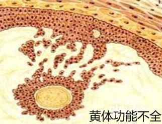 黄体_卵巢黄体破裂_黄体素