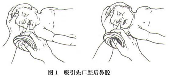婴儿呛奶_婴儿吃奶时呛奶_婴儿呛奶了怎么办