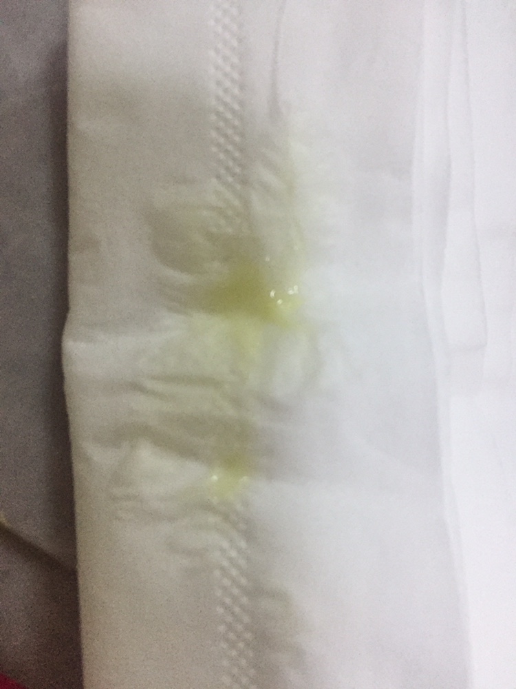 卵泡期黄体生成素偏低_黄体_黄体期