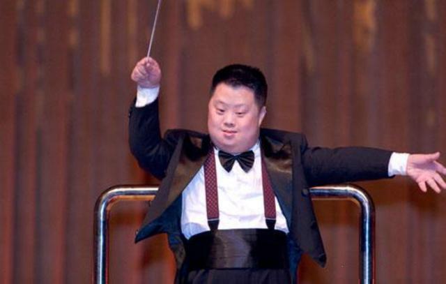 为什么“唐氏儿”都长着同一张脸?和这些原因有关,父母要知道