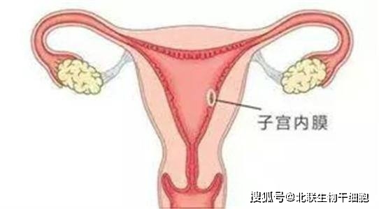 幼稚子宫 内膜显示不清_内膜正常子宫会粘连_子宫内膜薄