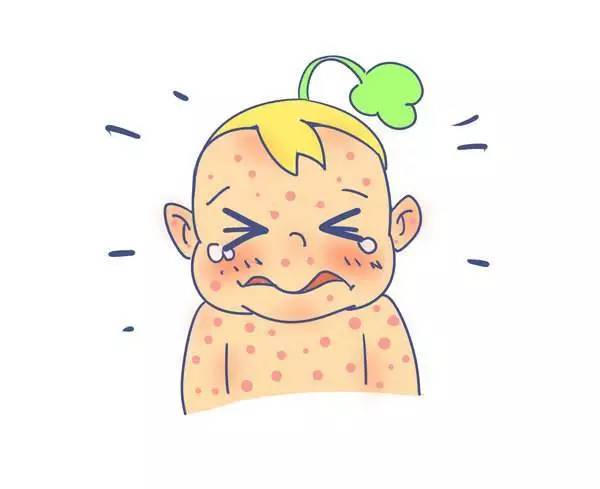 幼儿急疹的症状与治疗_幼儿急疹图片症状_幼儿急疹