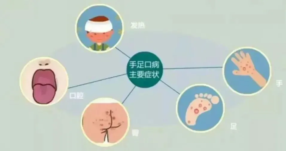幼儿急疹_幼儿急疹的症状与治疗_幼儿急疹图片症状