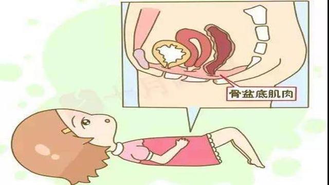 盆底肌修复