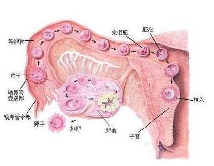 重度宮腔粘连图片_单腔造瘘和双腔造瘘_宫腔粘连