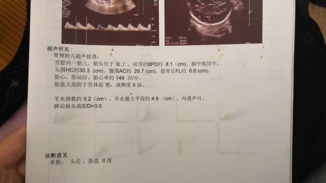 巨大儿_巨大美少女_巨大奇迹
