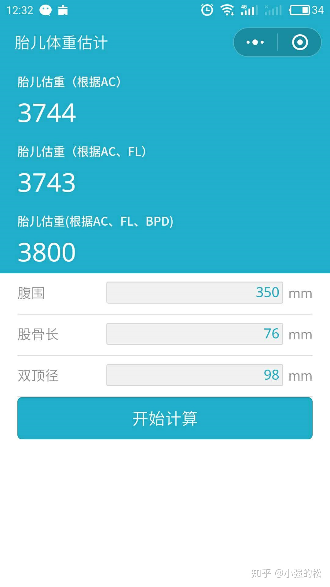 巨大儿