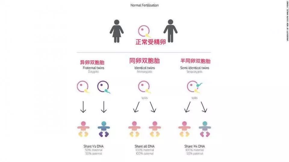 异卵双胞胎_同卵双胞胎_同卵与异卵双胞胎