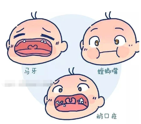 婴儿呛奶_婴儿呛奶了怎么办_婴儿总是呛奶怎么办