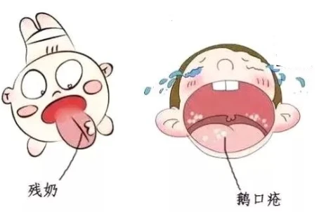 婴儿呛奶了怎么办_婴儿总是呛奶怎么办_婴儿呛奶