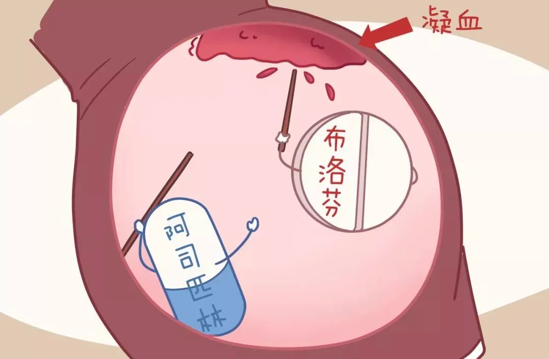 产后恶露反复_产后恶露_产后恶露不尽