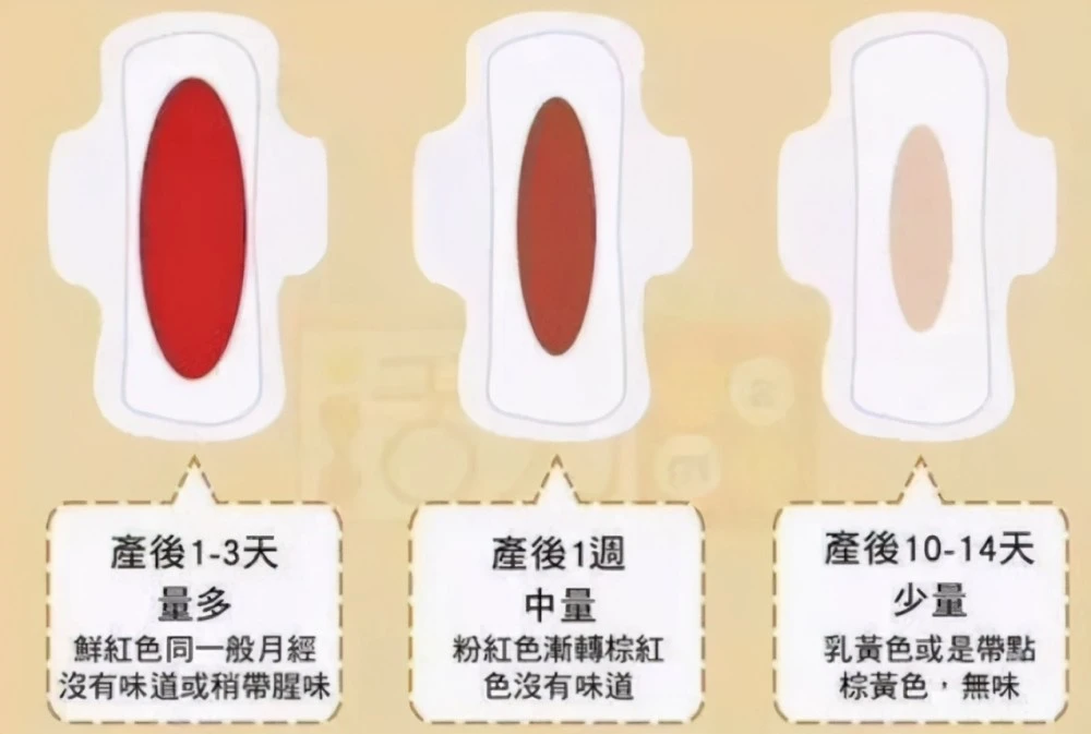 产后恶露