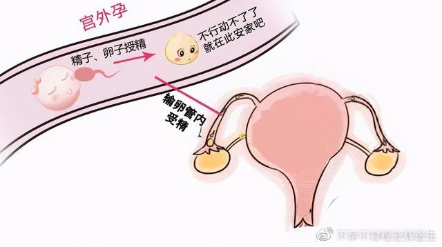 同卵双胞胎和异卵双胞胎_同卵异卵双胞胎_同卵双胞胎