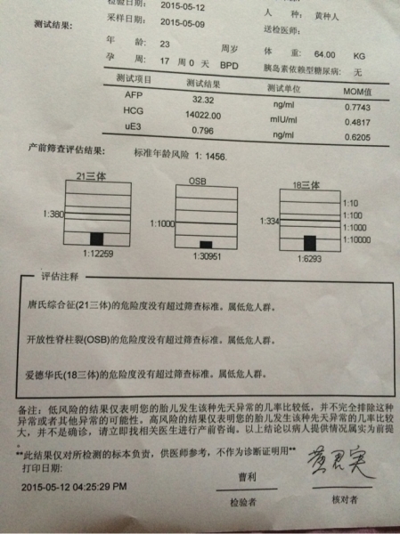囤积症对应的是什么症_唐氏综合症_唐氏总和症