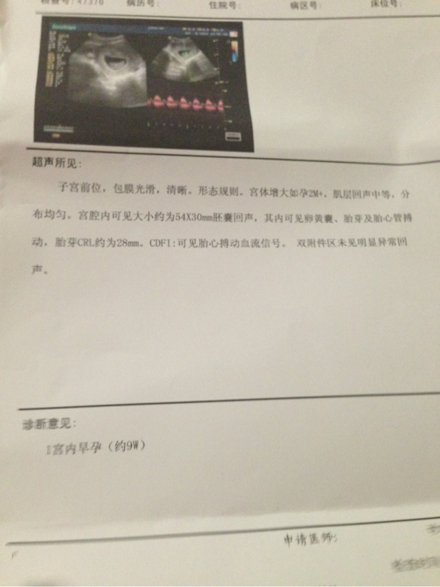 唐氏综合症_唐氏总和症_囤积症对应的是什么症