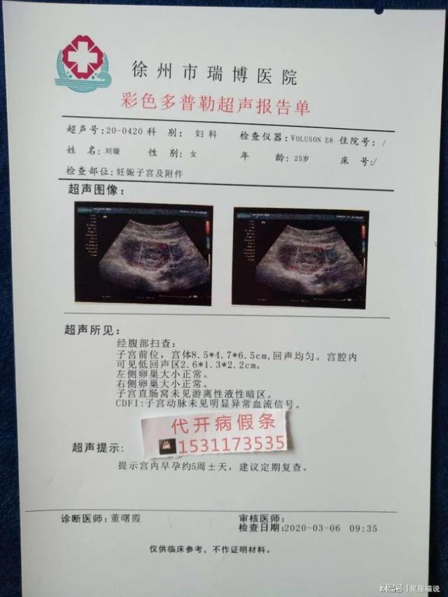 正常人的hcg值是多少_hcg值范围是多少正常_hcg正常值