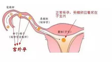hcg正常值_正常人的hcg值是多少_hcg值范围是多少正常