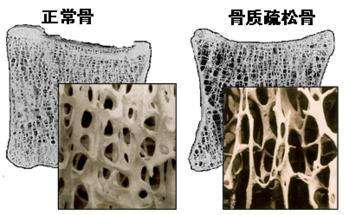 黄体生成激素低怎么办_促甲状腺激素低原因_雌激素低怎么办