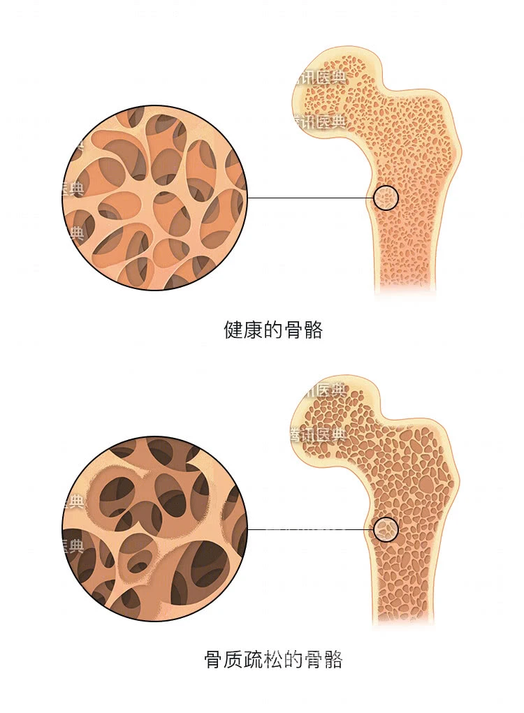 雌激素低怎么办_促甲状腺激素低原因_黄体生成激素低怎么办