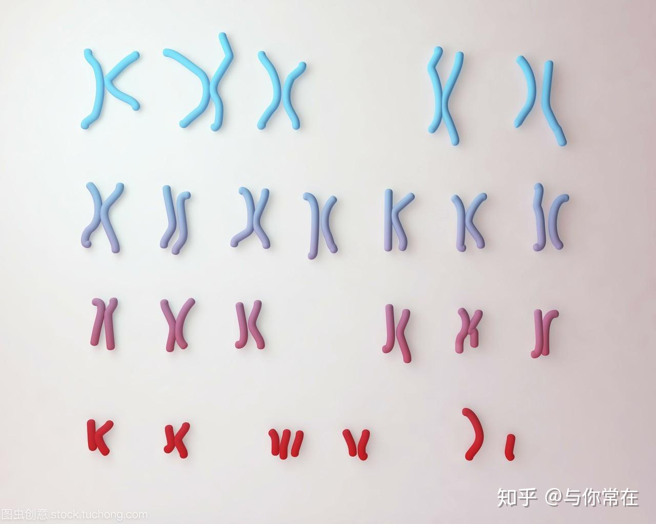 特纳氏综合症