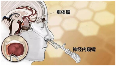 黄体铜_黄体不足_黄体素