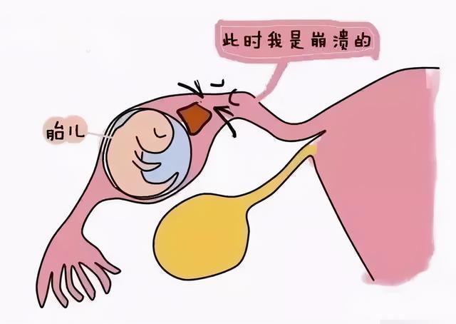黄体素_黄体铜素_妊娠黄体和月经黄体
