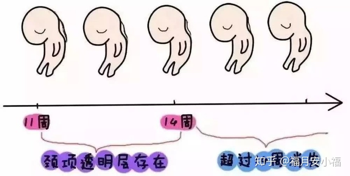 nt检查