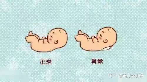 nt检查