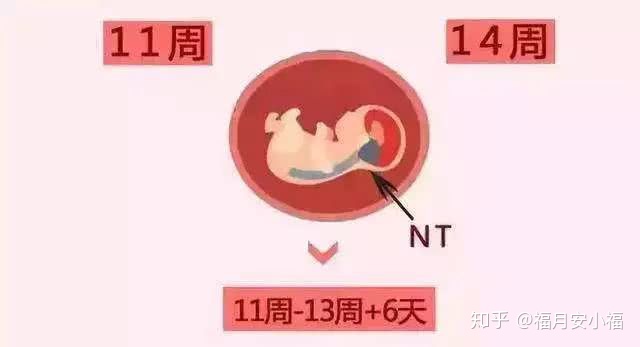 nt检查