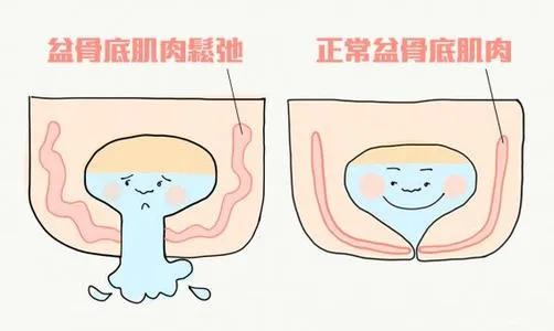 盆底肌修复_盆底肌康复训练_女性骨盆附盆底肌和神经模型