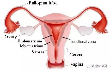 子宫腺肌症