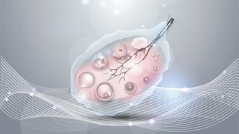 子宫腺肌症PPT下载