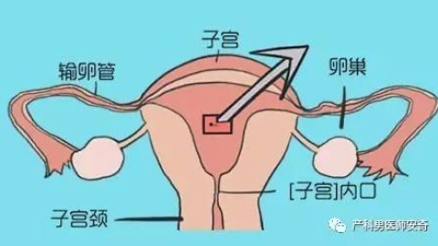 产后恶露什么时候干净才算正常？
