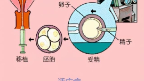 如何进行人工辅助生育？