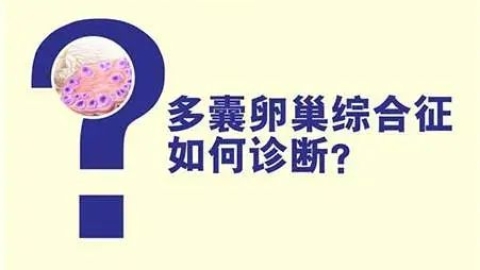 多囊卵巢一定就是多囊卵巢综合征吗？