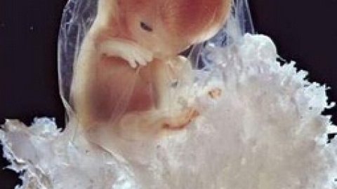 辅助生殖技术的利弊是什么？辅助生殖的技术有哪些