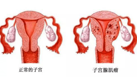 宫腔镜检查，这些常识你要知道！