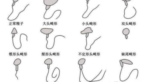 什么是弱精症