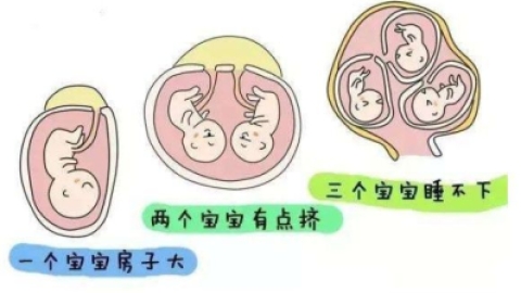 多胎妊娠ppt精选课件