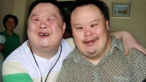唐氏综合症_临床医学_医药卫生_专业资料