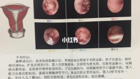 > 宫腔镜检查与治疗