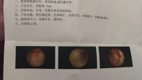 宫腔镜检查，分享我的经历给大家
