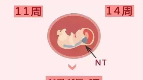nt检查 NT检查和B超有什么区别? 原来分别是这么回事, 孕妇一定要分清