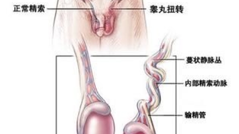 > 男科科普（一）：睾丸扭转----这种蛋疼闲不得