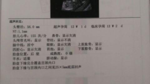 nt检查 NT检查_基础医学_医药卫生_专业资料