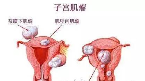 宫腔镜检查是什么
